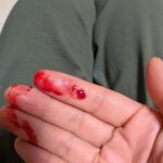 春はのぼせの季節です